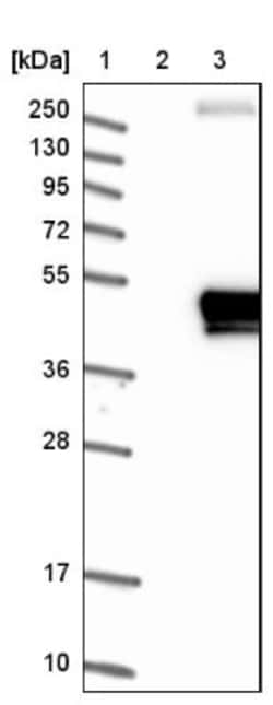 HFE Antibody, Novus Biologicals 25 &mu;L | Buy Online | Novus Biologicals | Fisher Scientific